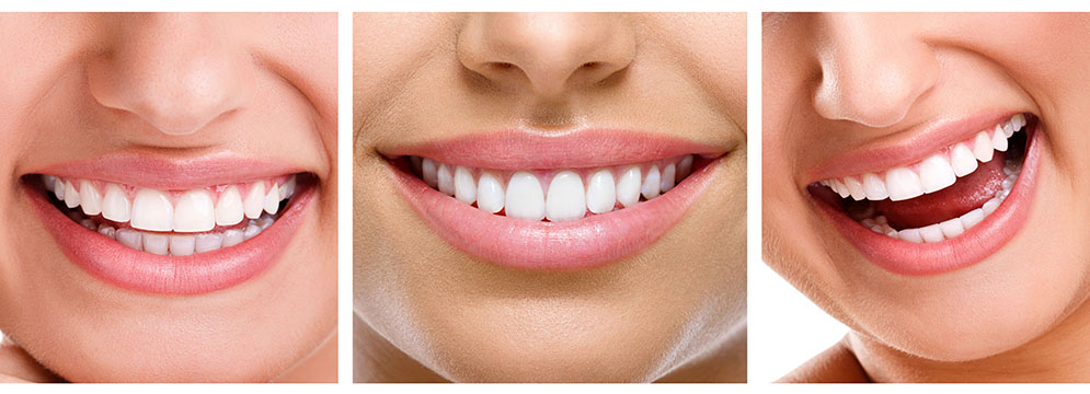 طراحی طرح لبخند