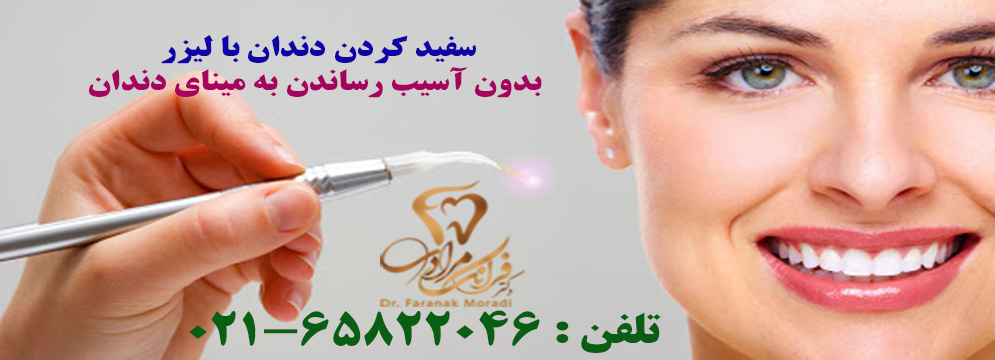سفیدکردن دندان(بیلیچینگ) با لیزر